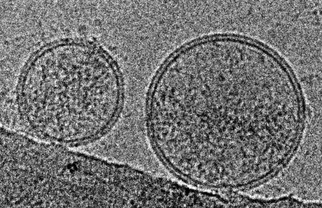 BJN#262: bourse coup de pouce du CJN: production de vésicules extracellulaires par les cellules B régulatrices: vers de nouvelles approches thérapeutiques en transplantation ?